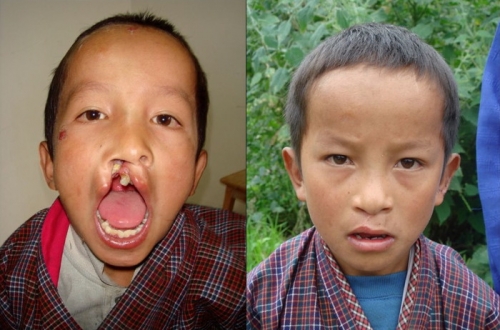 Bhutan 2006/2007